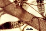 7 – Dettaglio della figura precedente che evidenzia la zona corticale e la porzione basale di uno stichidio
